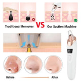 MULTIFUNCTIONAL 5 IN 1 ELECTRIC RECHARGEABLE DERMA SUCTION BLACKHEAD REMOVER DEVICE FACE PORES CLEANSING VACUUM MACHINE DERMA ACNE OIL REMOVING SUCTION DEVICE