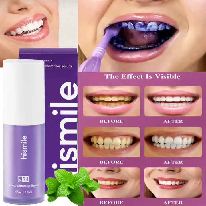 Hismile v34 Colour Corrector Serum Purple Teeth Whitening & Stain Removal Secondary image